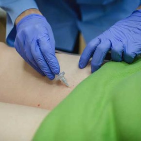 KARBOKSYTERAPIA DLA ZAAWANSOWANYCH KARBOKSYTERAPIA DLA ZAAWANSOWANYCH