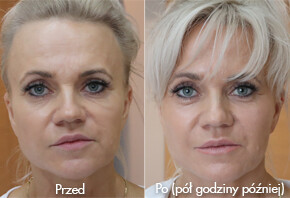 Asymetria twarzy, czyli jak w pół godziny poprawić życie Asymetria twarzy, czyli jak w pół godziny poprawić życie